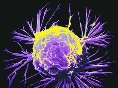 Учени разгадаха тайната на рака