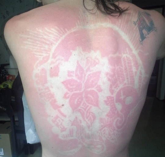 Най-новата мода: Татуировки от слънчево изгаряне! (Снимки)
