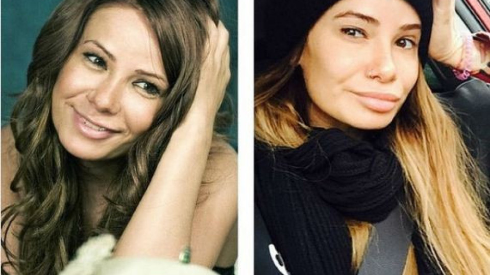 Известни руски красавици, които легнаха под ножа (Вижте дали им се получи?)