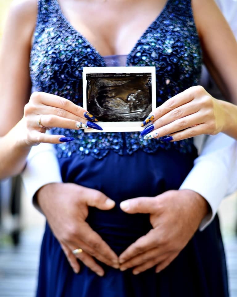 Антония Петрова показа бременното си коремче в специална фотосесия (Много снимки)
