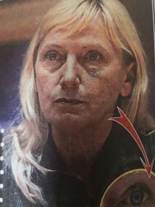 Елена Йончева лъсна с насинено око (Какво се случва с евродепутатката?)