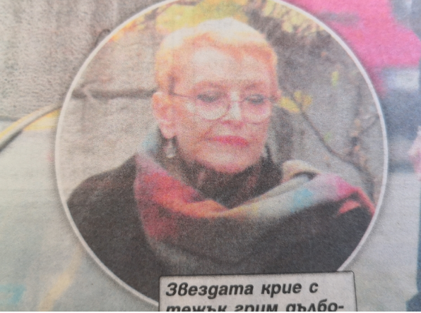 Лицето на Камелия Тодорова съвсем се спихна (Вижте как я окепази пластичен хирург)