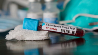 Австралийски учени с ново разкритие за коронавируса