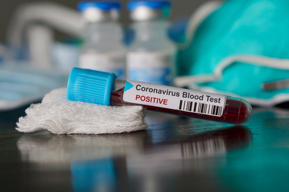 Пробив в Израел: Тест открива коронавирус само за 15 минути