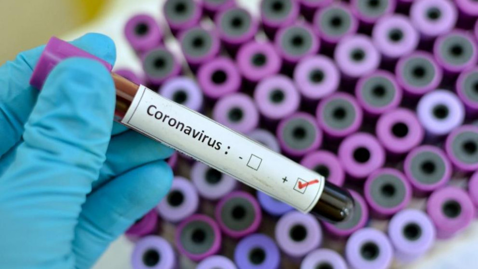 Учени откриха още един необичаен симптом на коронавирус