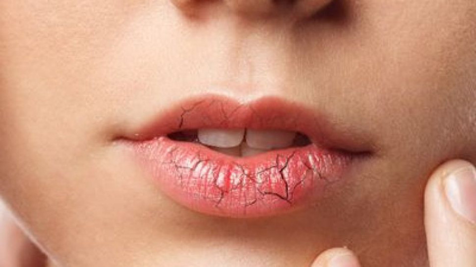 Лекар разкри три нехарактерни признака за рак на устата!