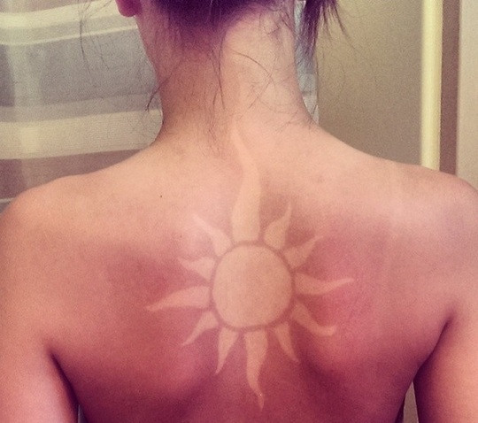 Най-новата мода: Татуировки от слънчево изгаряне! (Снимки) - Снимка 4
