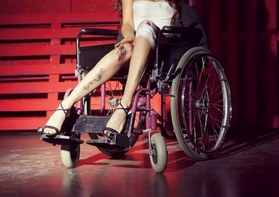 Известна фолк звезда се показа в инвалидна количка, пребита до неузнаваемост (ФОТО)