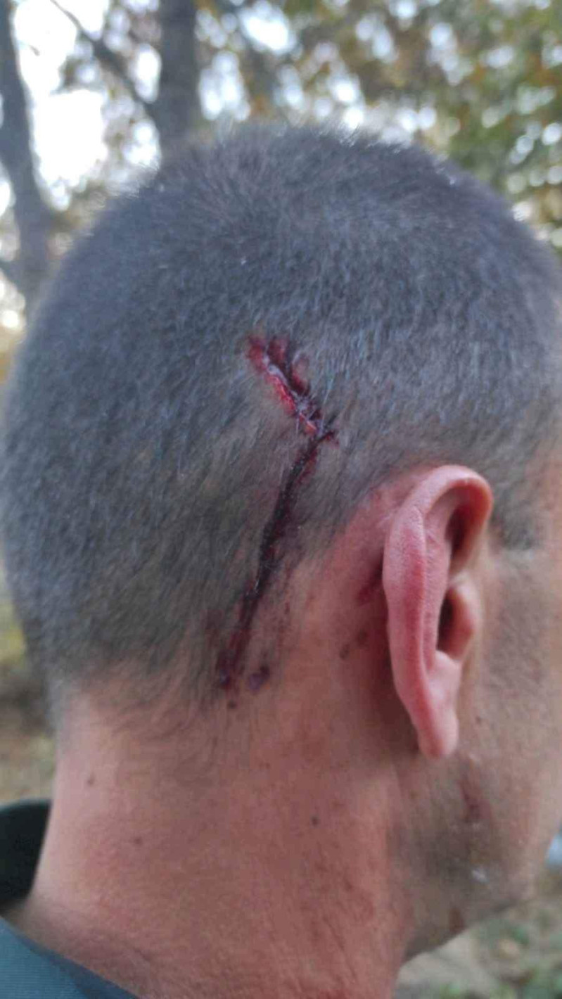 Вижте кадри от атаката срещу български граничари, довела до видеото с ранен мигрант - Снимка 4