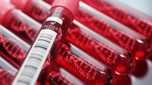 Учени са достигнали до заключението че притежателите на различни кръвни