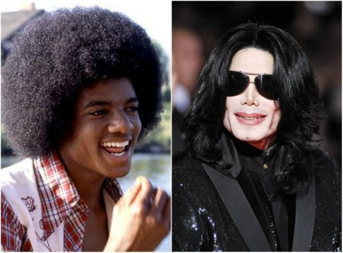 Защо Майкъл Джексън постоянно си кълцаше носа?