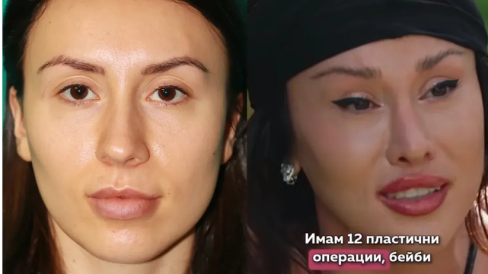 Санта Китана шокира с 12 пластични операции за фатален котешки поглед