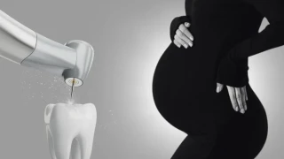 Всичко за лечението на зъб по време на бременност